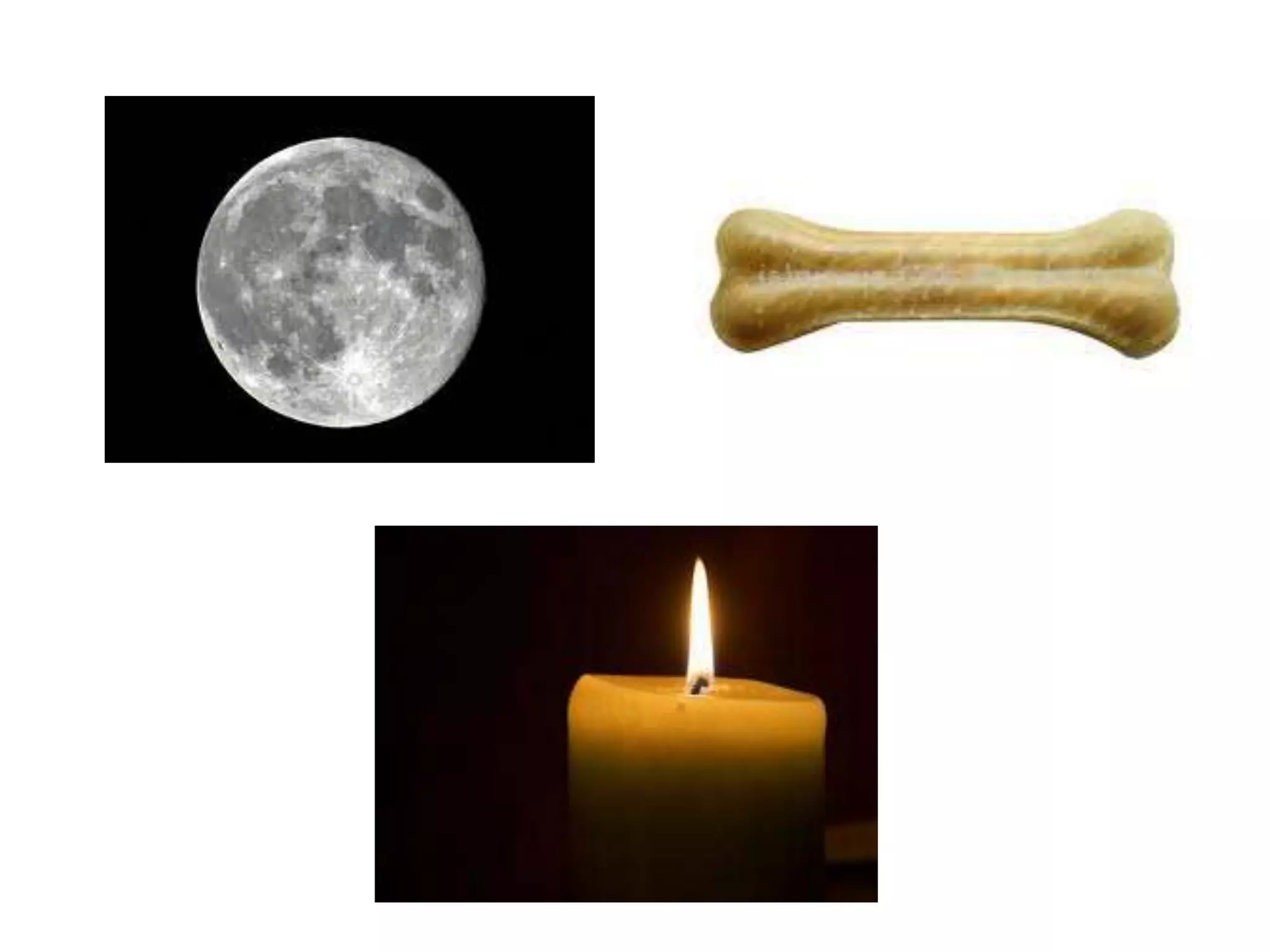 Gancyclovir implant in CMV Retinitis.