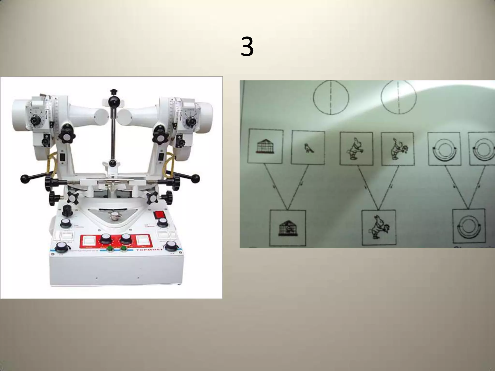 Corneal topographyTo diagnose early keratoconus    To quantify irregular astigmatism, to evaluate changes in corneal shape before & after refractive surgery