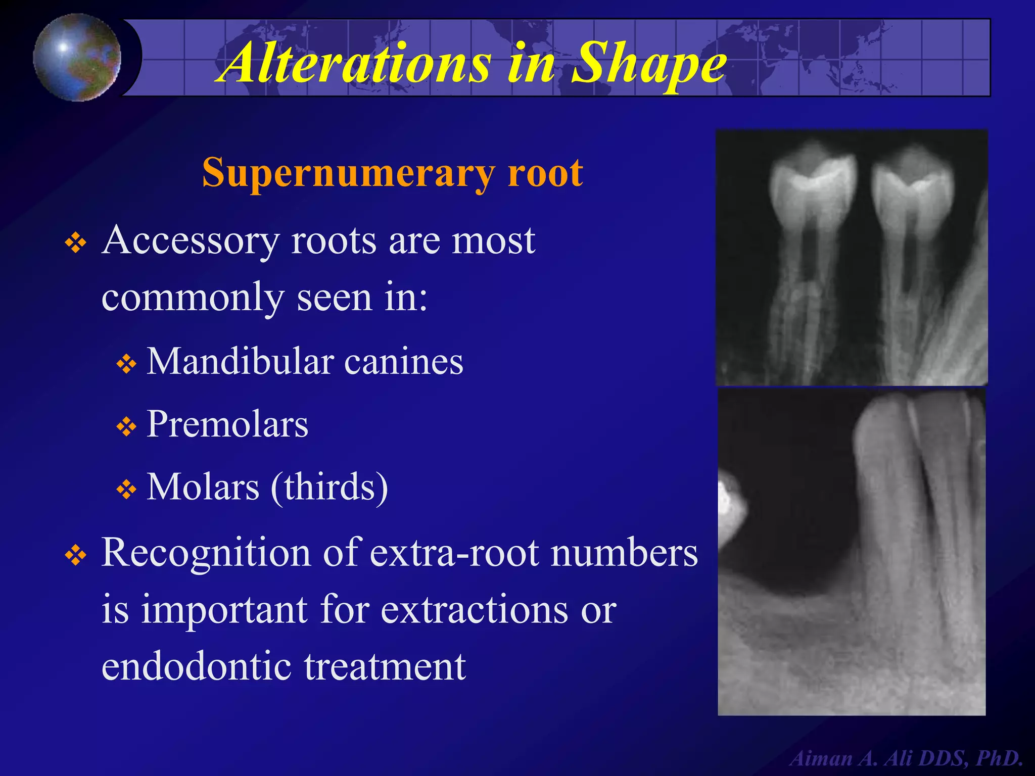 Alterations in Shape
Supernumerary root


Accessory roots are most
commonly seen in:
 Mandibular

canines

 Premolars
 Molars



(thirds)

Recognition of extra-root numbers
is important for extractions or
endodontic treatment
Aiman A. Ali DDS, PhD.

 