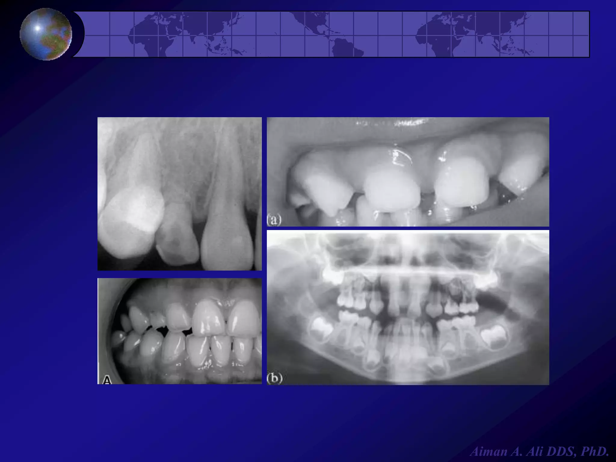 Aiman A. Ali DDS, PhD.

 