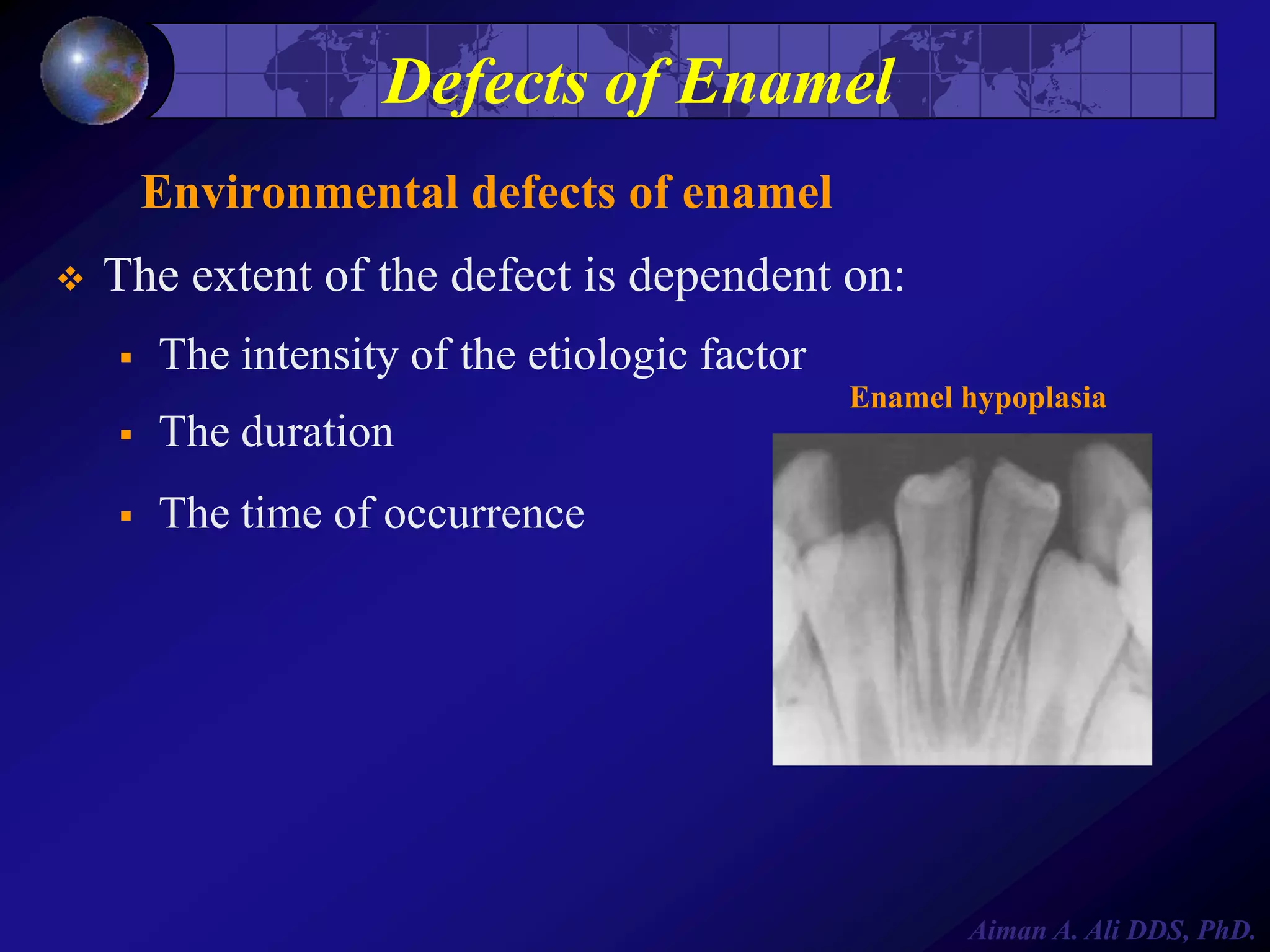 Defects of Enamel
Environmental defects of enamel


The extent of the defect is dependent on:


The intensity of the etiologic factor
Enamel hypoplasia



The duration



The time of occurrence

Aiman A. Ali DDS, PhD.

 