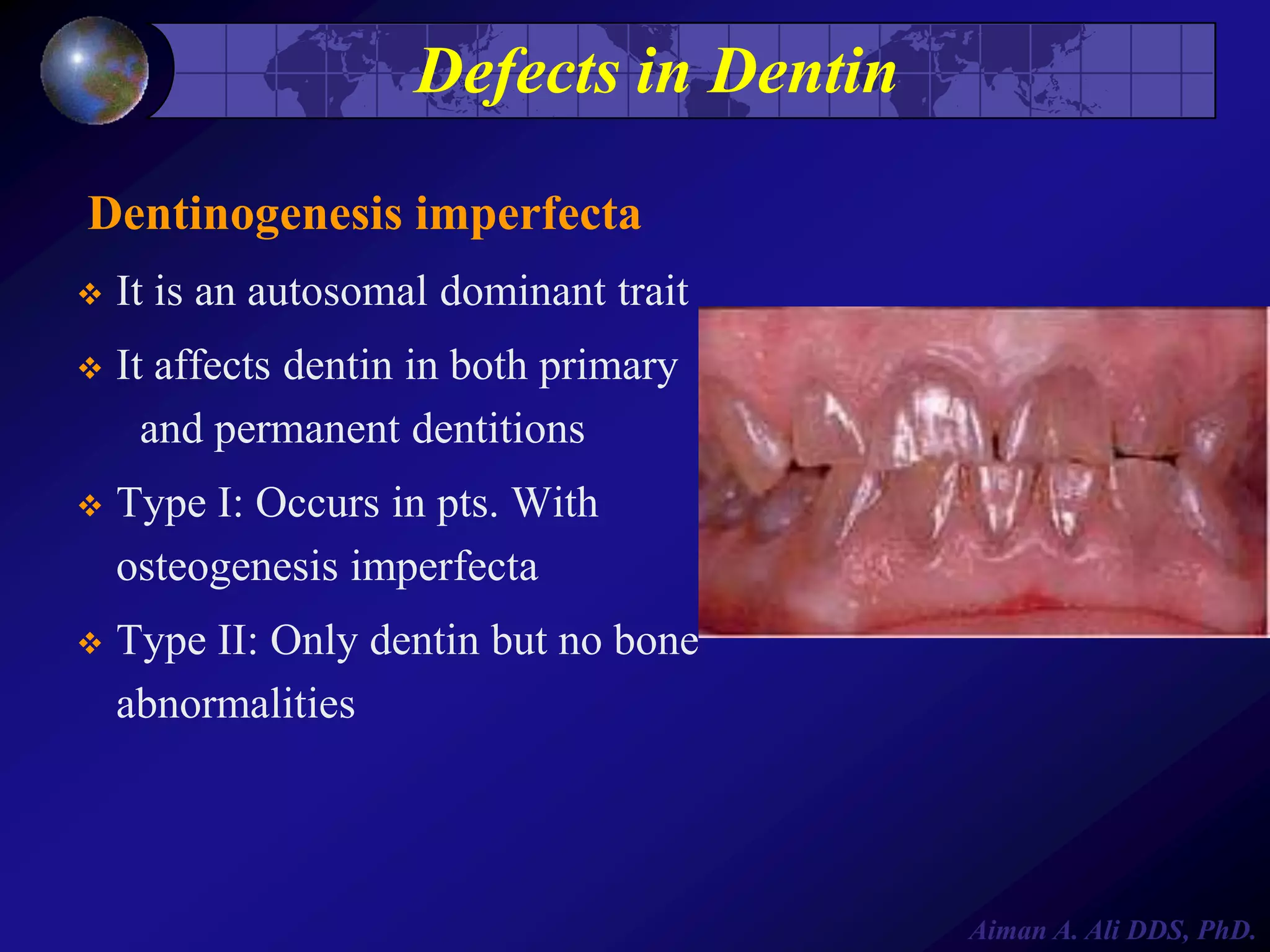 Defects in Dentin
Dentinogenesis imperfecta


It is an autosomal dominant trait



It affects dentin in both primary
and permanent dentitions



Type I: Occurs in pts. With
osteogenesis imperfecta



Type II: Only dentin but no bone
abnormalities

Aiman A. Ali DDS, PhD.

 