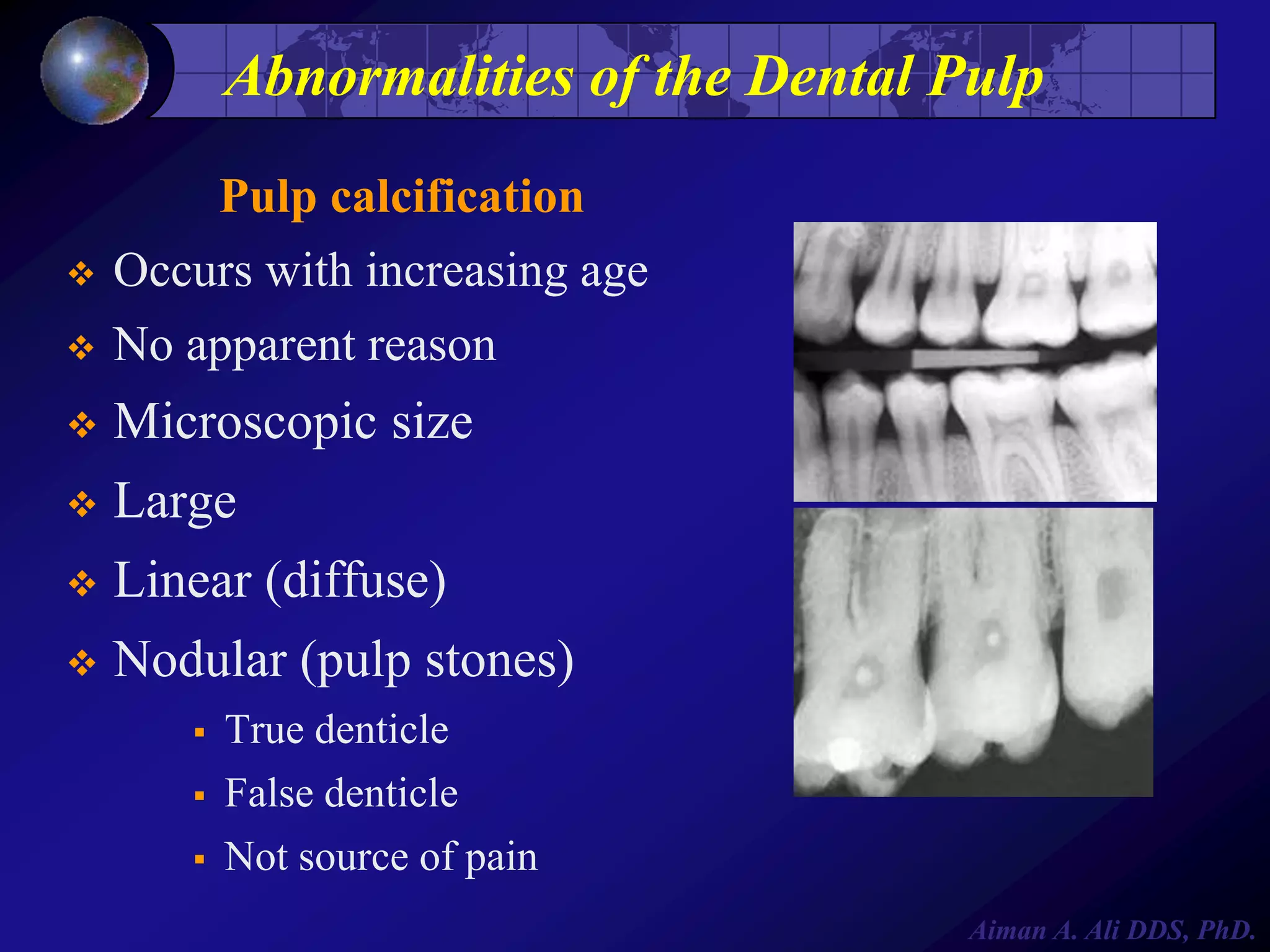 Abnormalities of the Dental Pulp
Pulp calcification


Occurs with increasing age



No apparent reason

Microscopic size
 Large


Linear (diffuse)
 Nodular (pulp stones)




True denticle



False denticle
Not source of pain



Aiman A. Ali DDS, PhD.

 