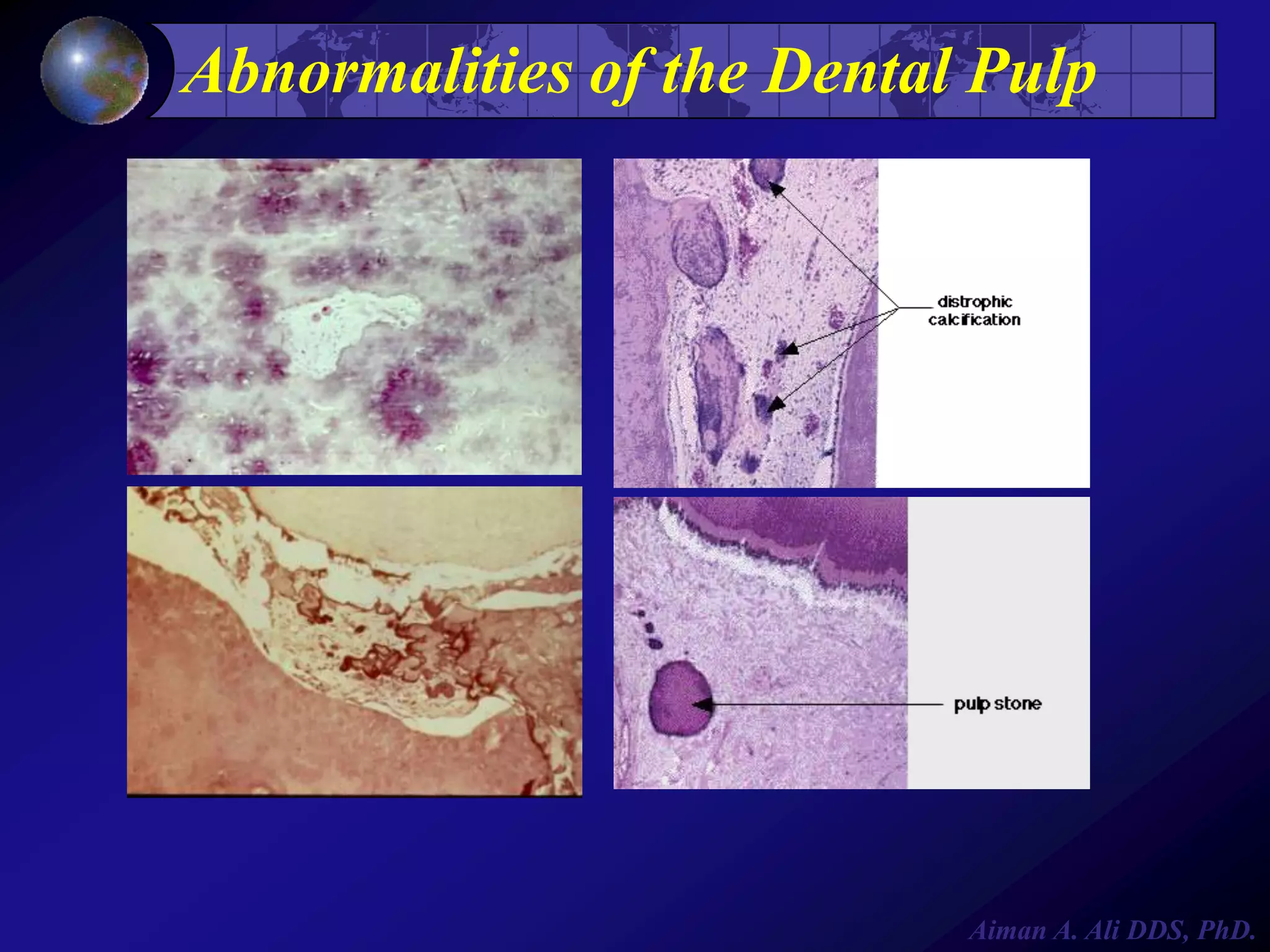 Abnormalities of the Dental Pulp

Aiman A. Ali DDS, PhD.

 