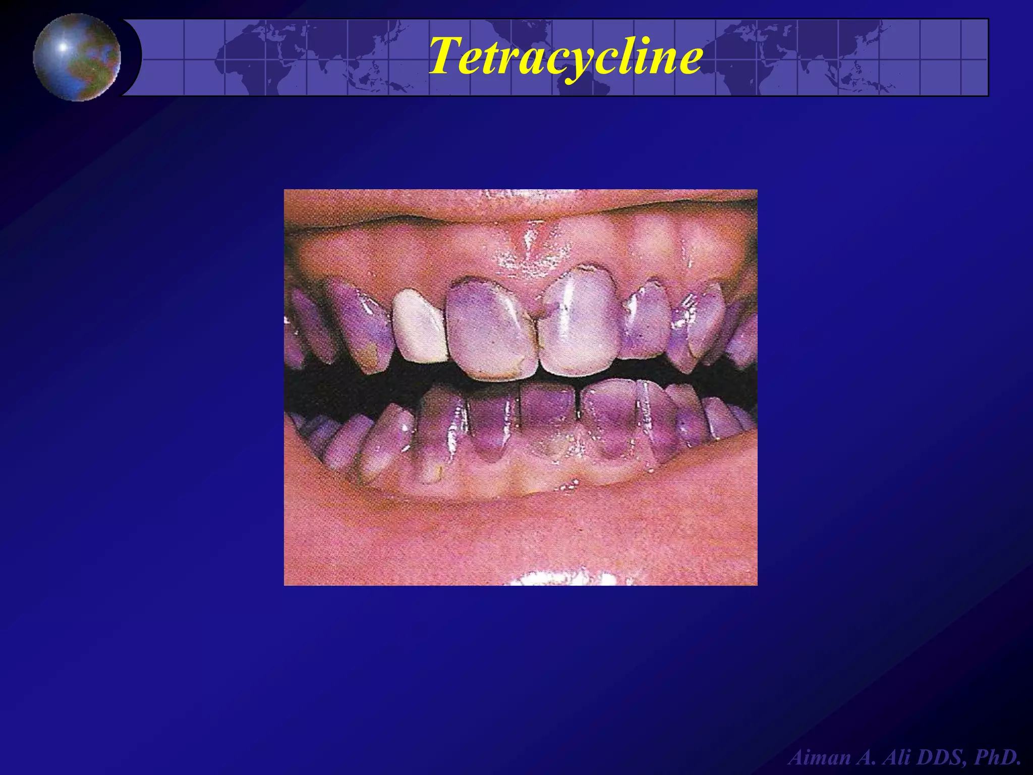 Tetracycline

Aiman A. Ali DDS, PhD.

 