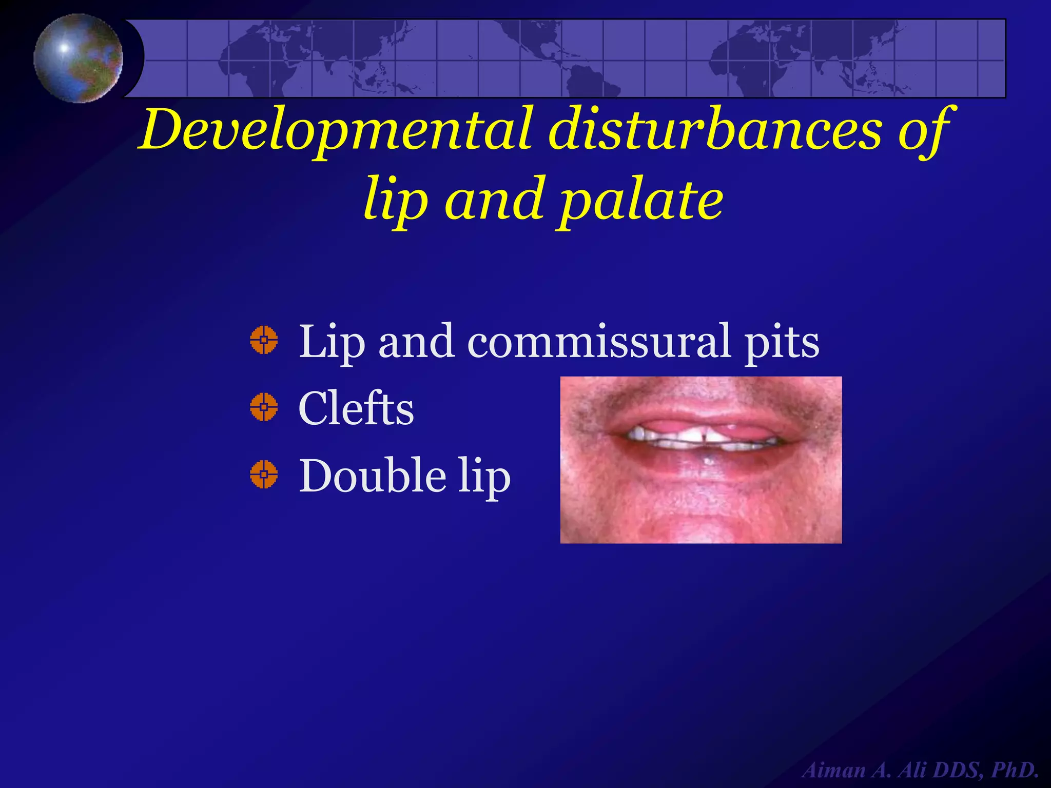 Developmental disturbances of
lip and palate
Lip and commissural pits
Clefts
Double lip

Aiman A. Ali DDS, PhD.

 