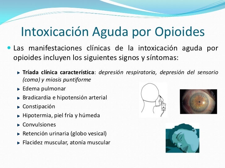 INTOXICACION POR OPIOIDES PDF