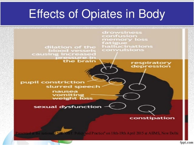 Opioid pharmacology an overview with emphasis on clinical 