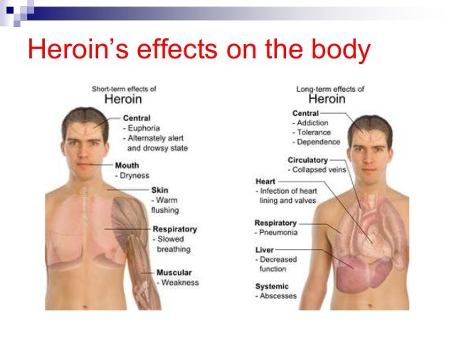 does demerol have codeine