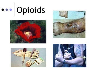 Opioids

 