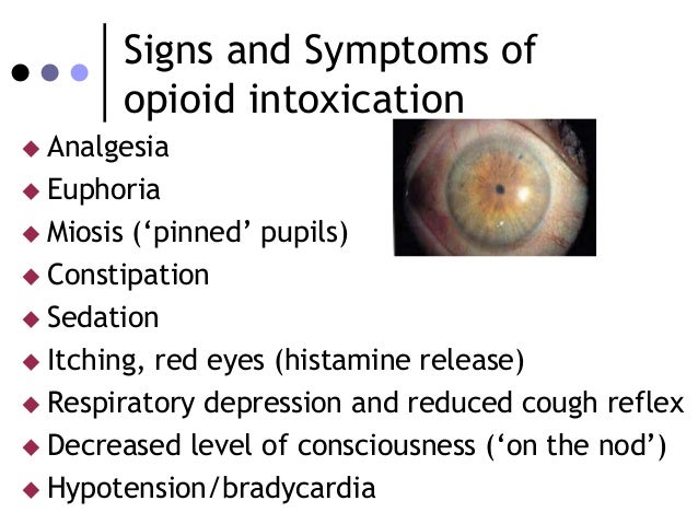 acute oxycodone overdose