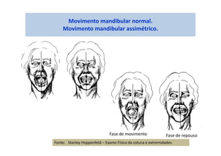 Movimento mandibular normal.
Movimento mandibular assimétrico.
Fase de movimento Fase de repouso
Fonte: Stanley Hoppenfeld – Exame Físico da coluna e extremidades.
 