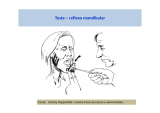 Teste – reflexo mandibular
Fonte: Stanley Hoppenfeld – Exame Físico da coluna e extremidades.
 