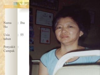 Nama   :  Ibu Ho Usia   :  55 tahun Penyakit  :  Campak 