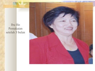 Ibu Ho Pemakaian setelah 3 bulan 