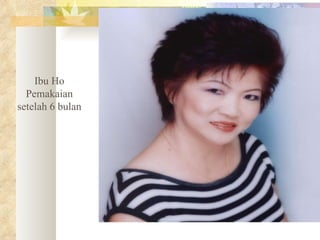 Ibu Ho Pemakaian setelah 6 bulan 
