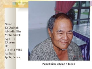 Pemakaian setelah 6 bulan Name :   En Zainoh Abindin Bin Mohd Sidek Age :   63 years  H/p :  016-532-9989 Address :   Ipoh, Perak 