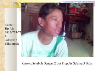 Kanker, Sembuh Dengan 2 Lot Propolis Selama 3 Bulan Name :   Bp Aja 0815-723-75006 Address :   Cikampek 