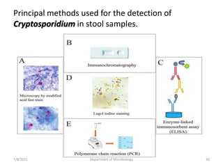 Principal methods used for the detection of
Cryptosporidium in stool samples.
7/8/2021 Department of Microbiology 30
 