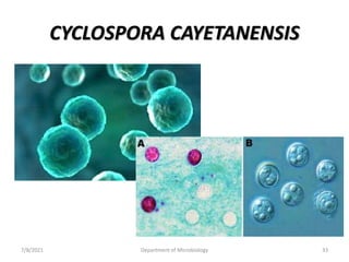 CYCLOSPORA CAYETANENSIS
7/8/2021 Department of Microbiology 33
 