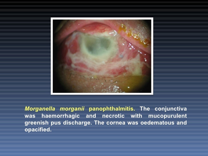 Opportunistic Enterobact