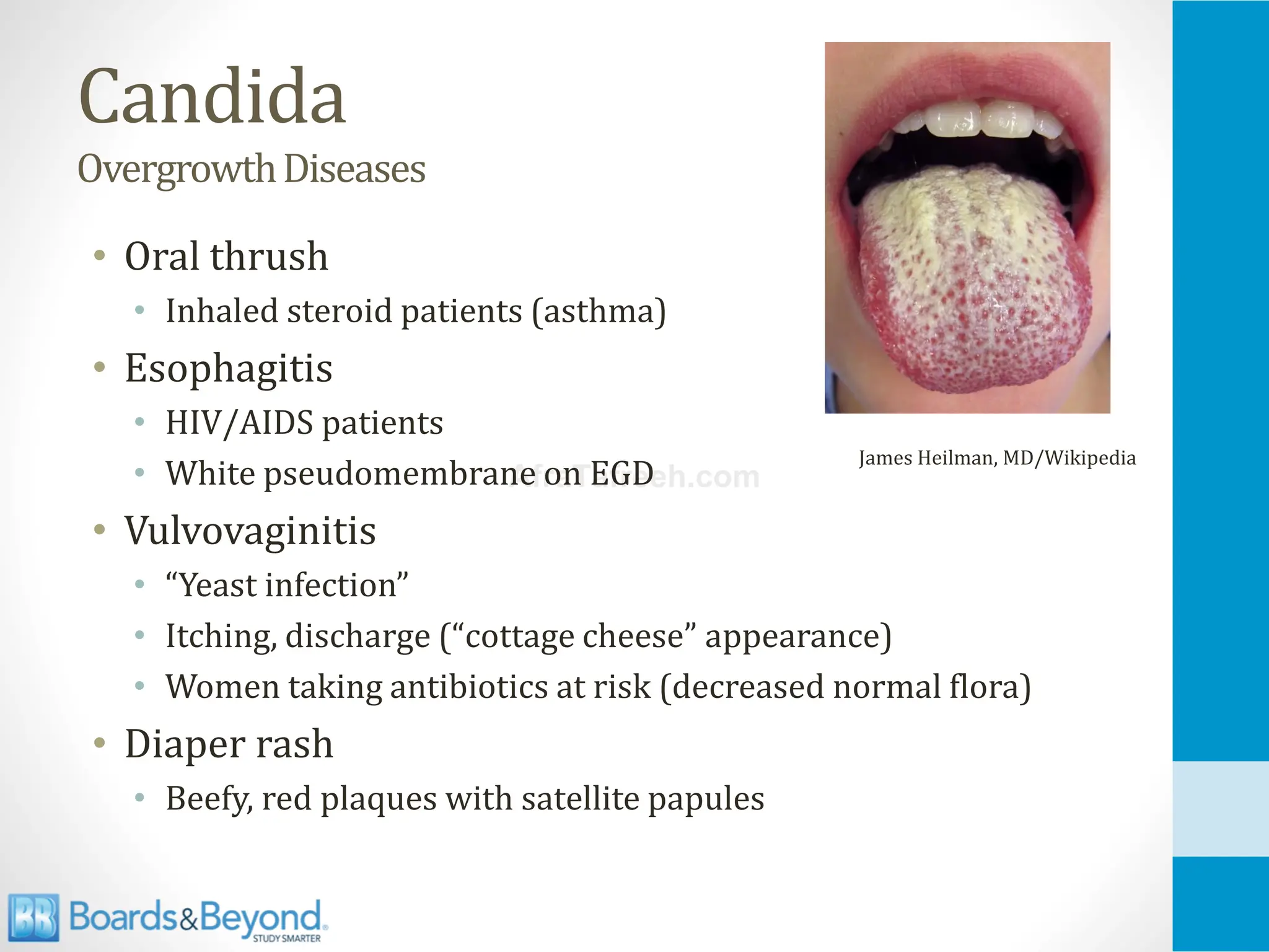 Opportunistic Fungal Infections atf.pdfnn | PDF