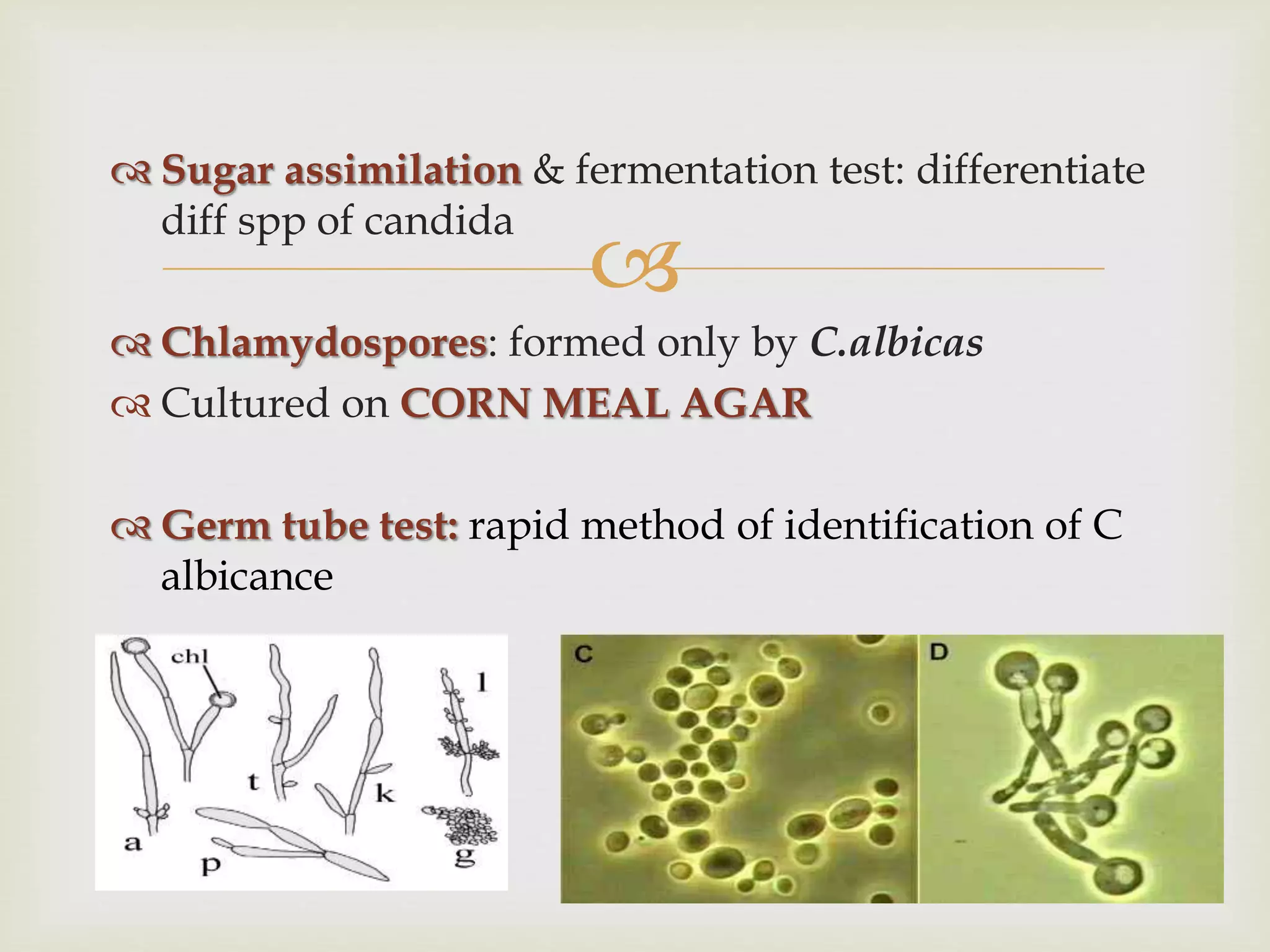 Opportunistic fungi mycology iii | PPTX