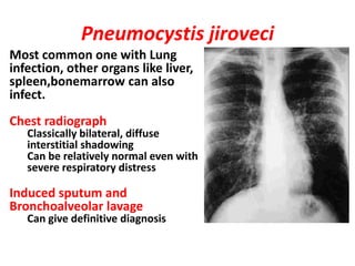 Pneumocystis jiroveci
Most common one with Lung
infection, other organs like liver,
spleen,bonemarrow can also
infect.
Chest radiograph
   Classically bilateral, diffuse
   interstitial shadowing
   Can be relatively normal even with
   severe respiratory distress

Induced sputum and
Bronchoalveolar lavage
   Can give definitive diagnosis
 