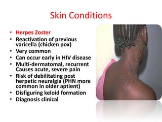 Skin Conditions
• Herpes Zoster
• Reactivation of previous
  varicella (chicken pox)
• Very common
• Can occur early in HIV disease
• Multi-dermatomal, recurrent
  Causes acute, severe pain
• Risk of debilitating post
  herpetic neuralgia (PHN more
  common in older aptient)
• Disfiguring keloid formation
• Diagnosis clinical
 
