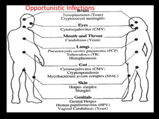 Opportunistic Infections
 