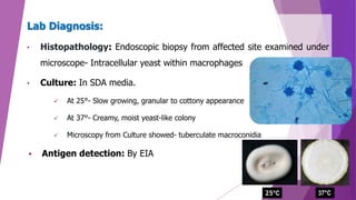 Lab Diagnosis:
• Histopathology: Endoscopic biopsy from affected site examined under
microscope- Intracellular yeast within macrophages
• Culture: In SDA media.
 At 25°- Slow growing, granular to cottony appearance
 At 37°- Creamy, moist yeast-like colony
 Microscopy from Culture showed- tuberculate macroconidia
 Antigen detection: By EIA
25°C 37°C
 