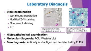  Stool examination
 Wet mount preparation
 Modified Z-N staining
 Fluorescent staining
 IIF
 Histopathological examination
 Molecular diagnosis: PCR, Western blot
 Serodiagnosis: Antibody and antigen can be detected by ELISA
Laboratory Diagnosis
Cryptosporidium spp.
oocysts (pink arrows) in
Cryptosporidium spp.
oocysts in modified Z-N
stain
 
