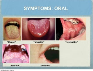 SYMPTOMS: ORAL
“thrush” “glossitis” “stomatitis”
“cheilitis” “perleche”
Monday, January 16, 2012
 