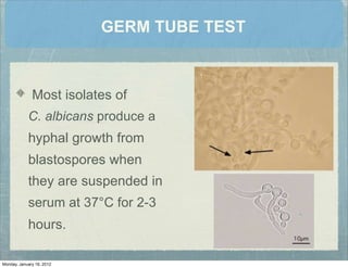 GERM TUBE TEST
Most isolates of
C. albicans produce a
hyphal growth from
blastospores when
they are suspended in
serum at 37°C for 2-3
hours.
Monday, January 16, 2012
 