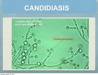 CANDIDIASIS
“chlamydoconidia”
Monday, January 16, 2012
 