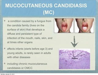 MUCOCUTANEOUS CANDIDIASIS
(MC)
a condition caused by a fungus from
the candida family (lives on the
surface of skin) that develops a
diffuse and persistent type of
infection of the mouth, nails, skin, and
at times other organs
affects infants (starts before age 3) and
young adults, is rarely seen in adults
with other diseases
including chronic mucocutaneous
candidaisis or CMCC
Monday, January 16, 2012
 