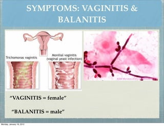 SYMPTOMS: VAGINITIS &
                                BALANITIS




        “VAGINITIS = female”

          “BALANITIS = male”

Monday, January 16, 2012
 