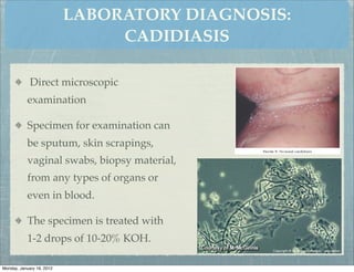 LABORATORY DIAGNOSIS:
                                CADIDIASIS

             Direct microscopic
           examination

           Specimen for examination can
           be sputum, skin scrapings,
           vaginal swabs, biopsy material,
           from any types of organs or
           even in blood.

           The specimen is treated with
           1-2 drops of 10-20% KOH.

Monday, January 16, 2012
 