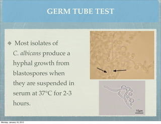 GERM TUBE TEST



              Most isolates of
            C. albicans produce a
            hyphal growth from
            blastospores when
            they are suspended in
            serum at 37°C for 2-3
            hours.

Monday, January 16, 2012
 