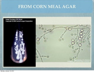 FROM CORN MEAL AGAR




Monday, January 16, 2012
 