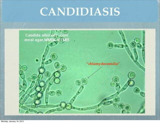CANDIDIASIS



                                 “chlamydoconidia”




Monday, January 16, 2012
 