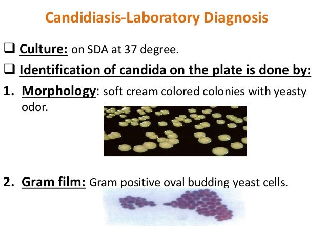 Opportunistic mycoses cadidiasis