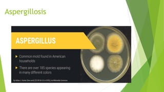 Aspergillosis
 