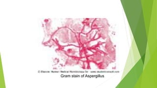 Gram stain of Aspergillus
 