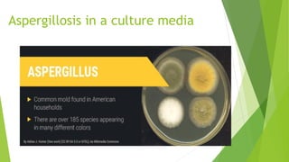 Aspergillosis in a culture media
 