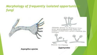 Morphology of frequently isolated opportunistic
fungi
Aspergillus species
Zygomycetes
 