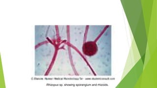 Rhizopus sp. showing sporangium and rhizoids.
 