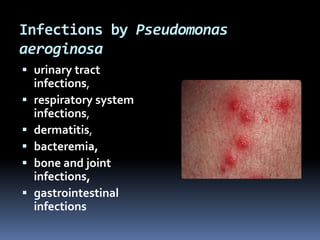 Infections by Pseudomonas
aeroginosa
 urinary tract
  infections,
 respiratory system
  infections,
 dermatitis,
 bacteremia,
 bone and joint
  infections,
 gastrointestinal
  infections
 
