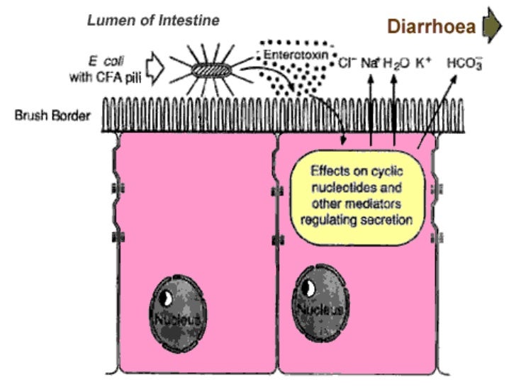 opportunistic pathogen