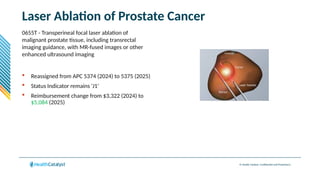 © Health Catalyst. Confidential and Proprietary.
Laser Ablation of Prostate Cancer
0655T - Transperineal focal laser ablation of
malignant prostate tissue, including transrectal
imaging guidance, with MR-fused images or other
enhanced ultrasound imaging
 Reassigned from APC 5374 (2024) to 5375 (2025)
 Status Indicator remains ‘J1’
 Reimbursement change from $3,322 (2024) to
$5,084 (2025)
 